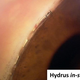 Illustration for article titled How a tiny eye implant could save your vision from glaucoma